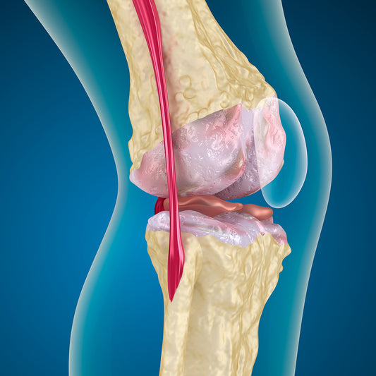 Symptoms Of Arthritis
