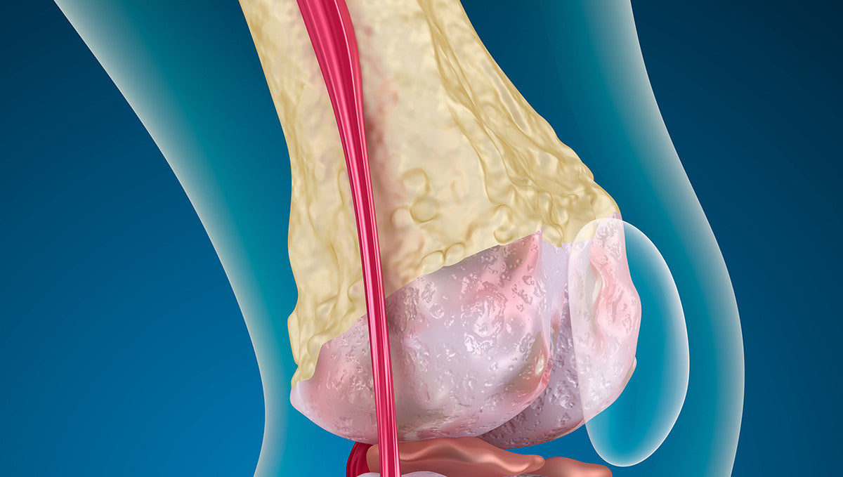 Salmon Collagen Fish Supplement To Cure Symptoms Of Arthritis