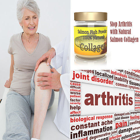 Salmon Collagen- Treatment for Rheumatoid Arthritis