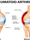 Salmon Collagen: Amazing Supplement to Give Relief from Painful Joints